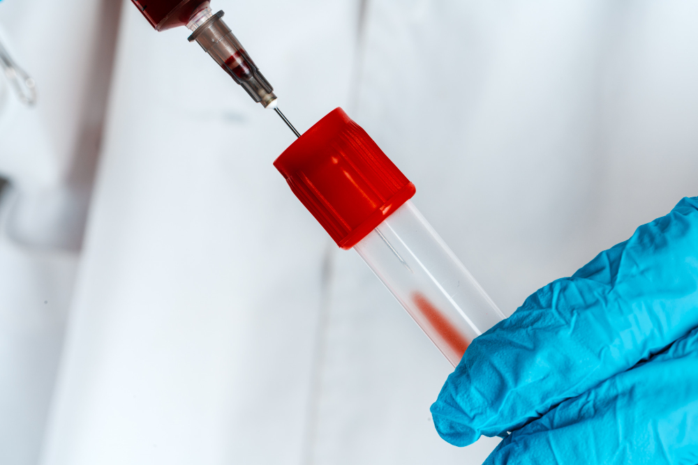 Infectious Disease Tests