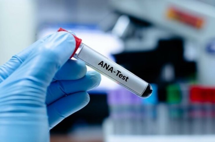 ANA