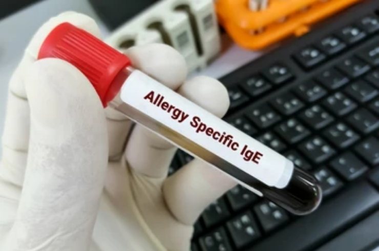 Allergy Screening IgE