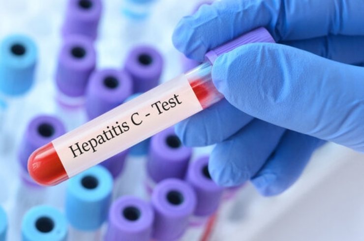 Anti-HCV