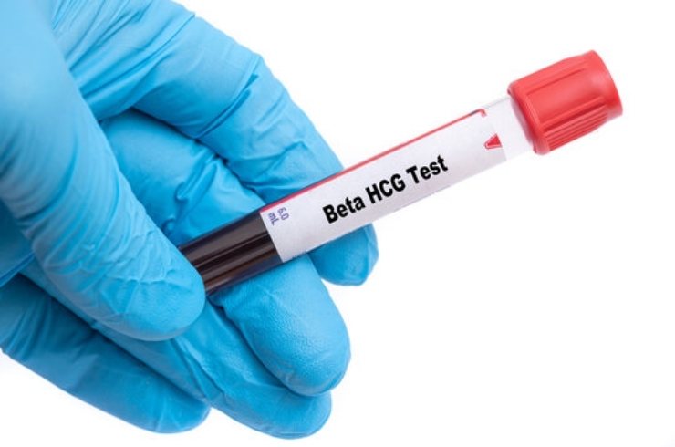Beta-hCG