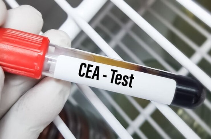 CEA