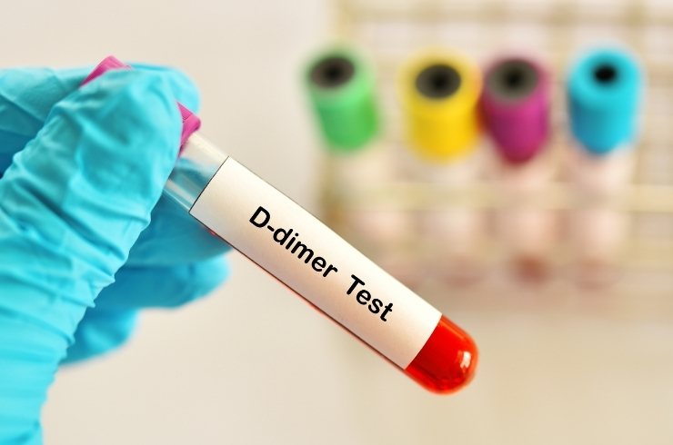 D-Dimer