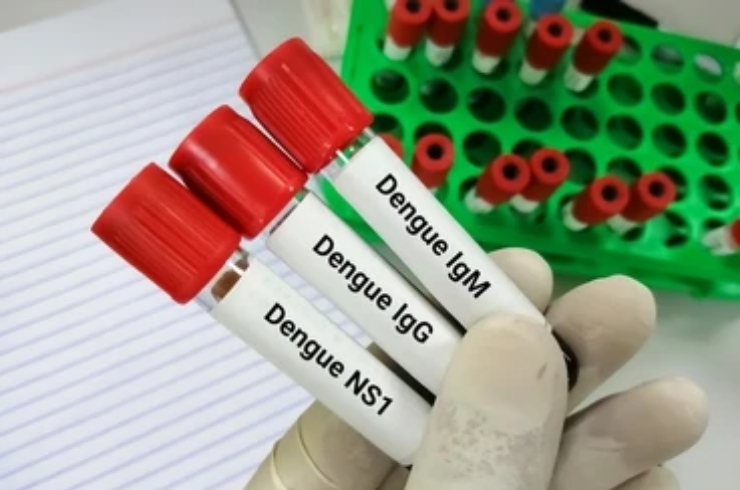 Dengue NS1, IgG, IgM