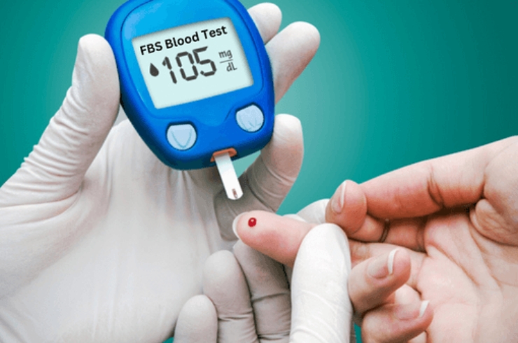 Fasting Blood Sugar (FBS)