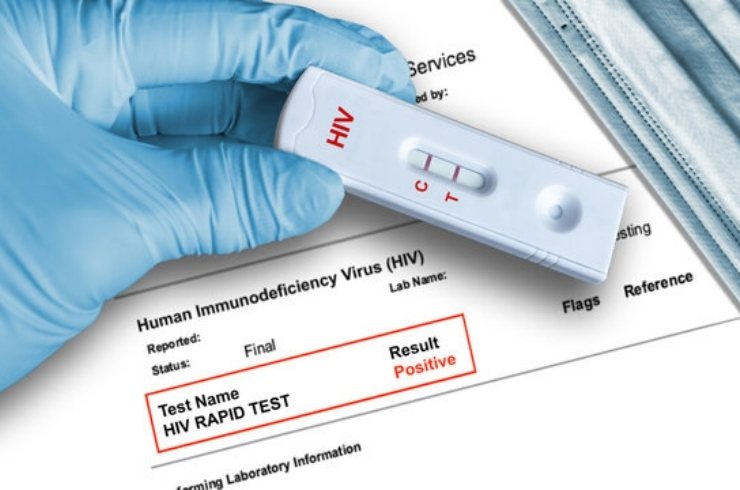 HIV 1 & 2