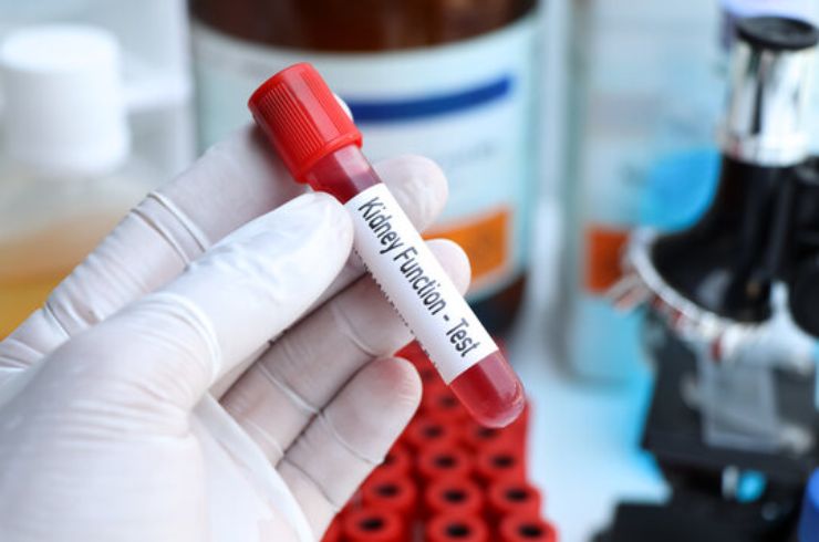 KidneyFunctionTests(KFT,RFT)