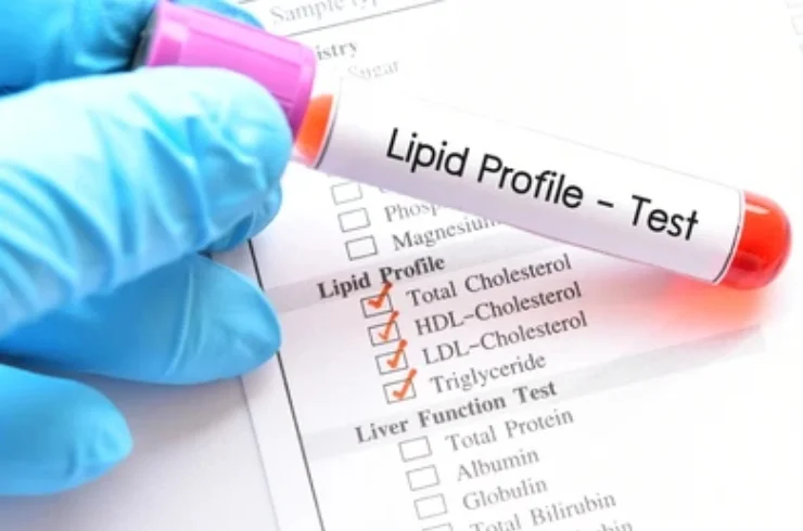 LipidProfile------3