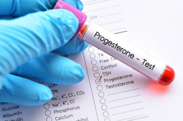 Progesterone, LH, FSH, AMH