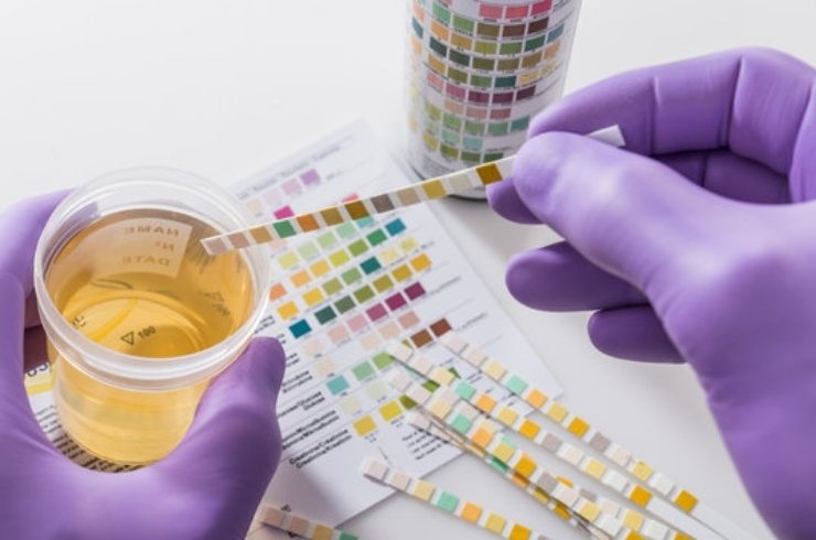 Routine Urine Examination