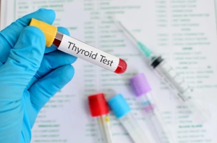 ThyroidprofileTest------01