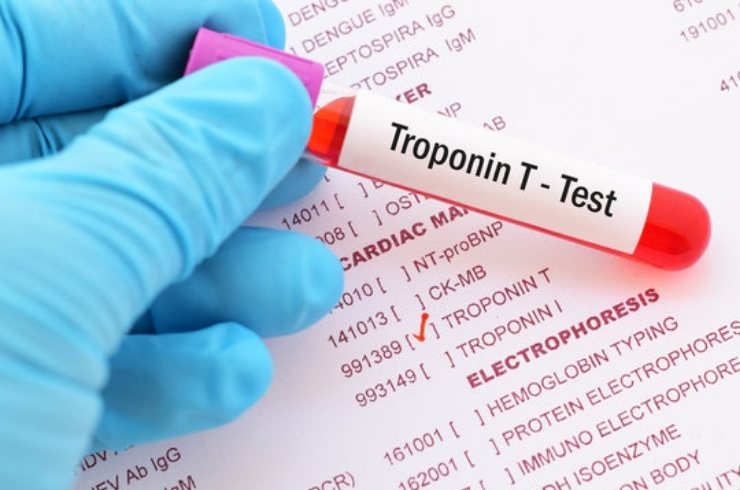 Troponin I / T