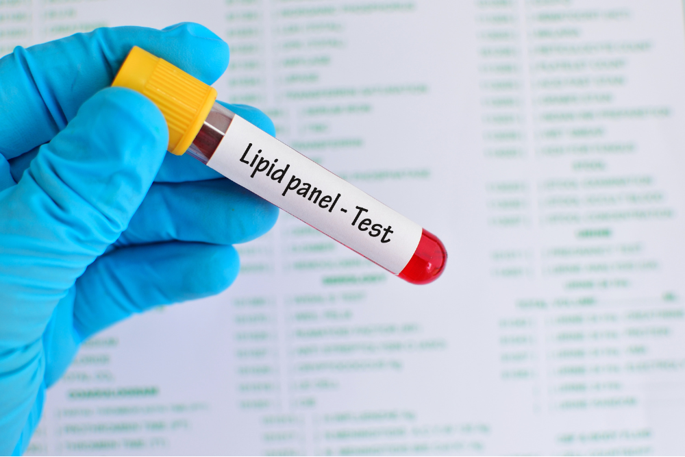 Urine Tests