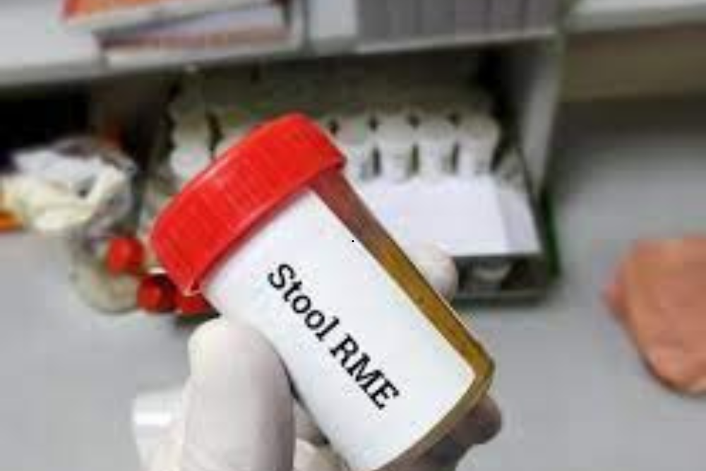 Stool Tests