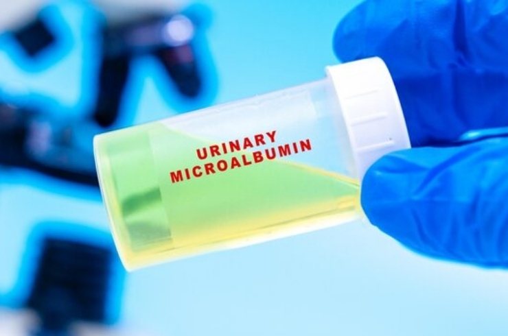 Urine for Microalbumin
